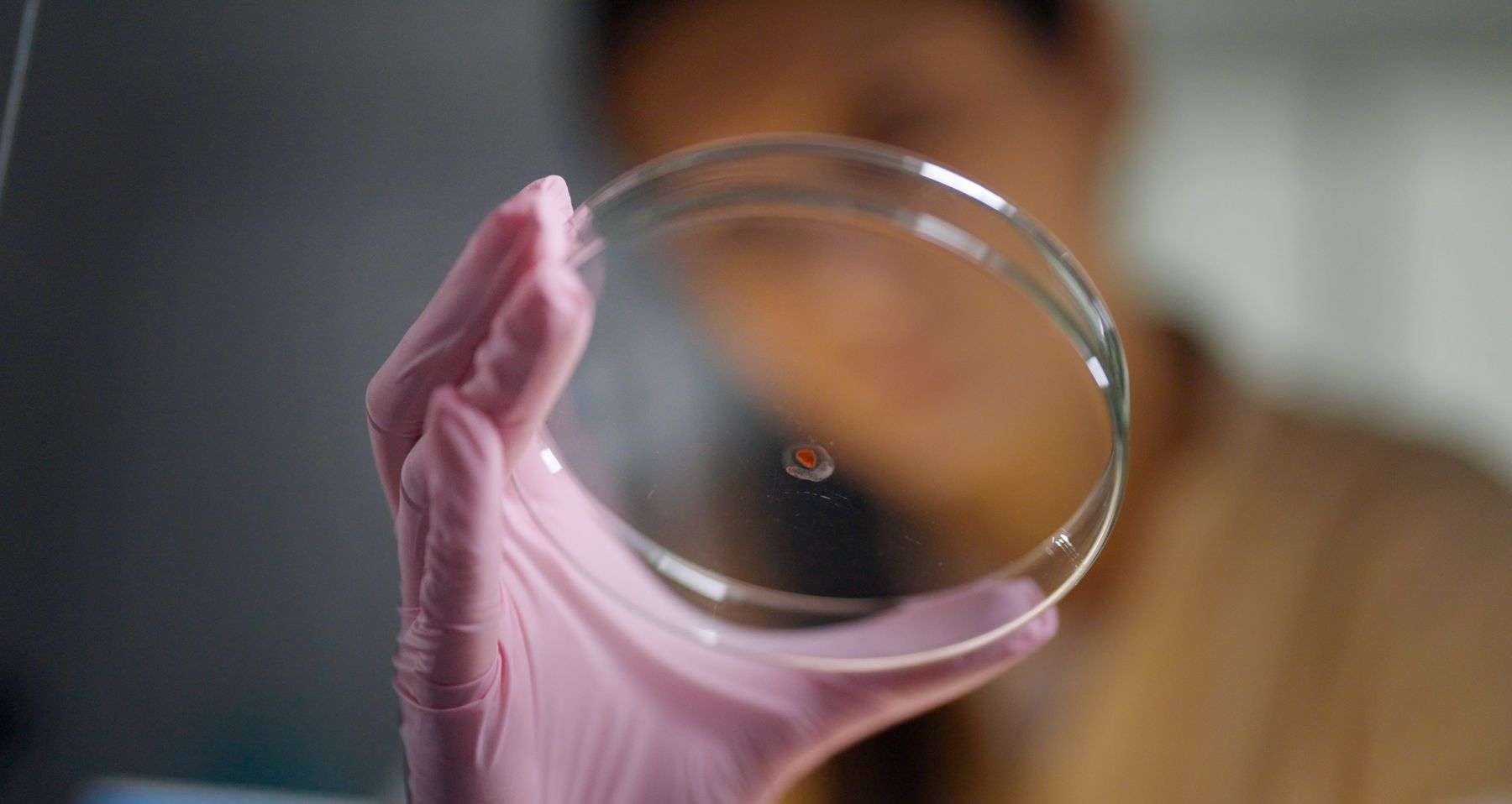 medizinische Mikrobiologie
